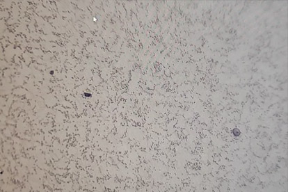 금속 검사-500 배 금속 검사